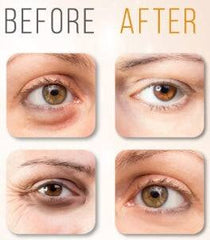 Eyeliss Solution Reducing Eye Puffiness & Dark Circles
